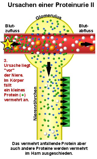 Schematische Darstellung der berlaufproteinurie