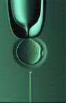 Spermieninjektion in die Eizelle