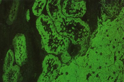 Fluoreszenzmuster eines LKM-Antikrpers auf Rattenleber/-niere