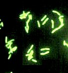 Legionellen mit fluoreszierendem Antikrper markiert
